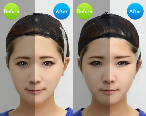 リフトアップテープ(コスプレ用テーピング) 07Cn99_